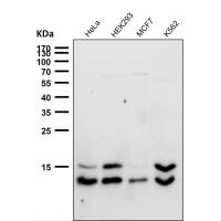 LC3B Rabbit mAb