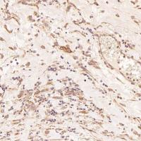 LC3B Rabbit mAb