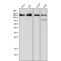 MGEA5 Rabbit mAb