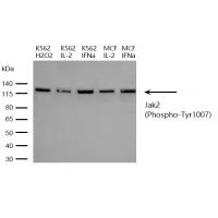 Jak2(Phospho-Tyr1007) Antibody