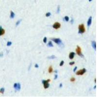 FOXE3 Antibody