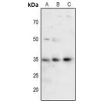 FOXE3 Antibody