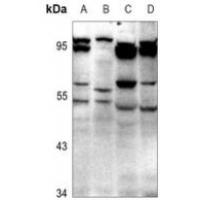 GABRD Antibody