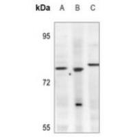 KLHL3 Antibody