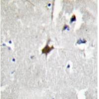 KLHL3 Antibody