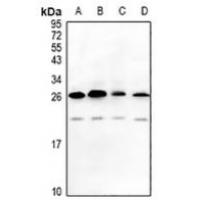 MAGEA5 Antibody