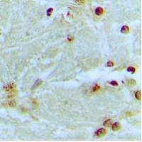 MED13L Antibody