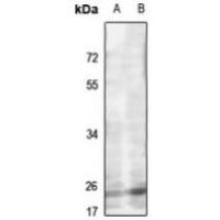 MRPL22 Antibody