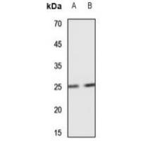 SCN4B Antibody