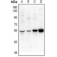 UEVLD Antibody