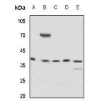 KCNAB3 Antibody