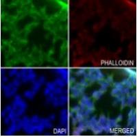 KCNAB3 Antibody