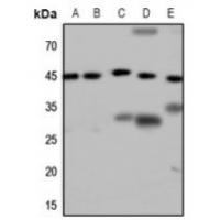 GALR2 Antibody