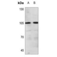 ADAMTS1 Antibody