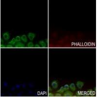 GPR143 Antibody