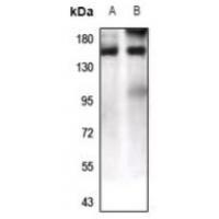 LPHN1 Antibody