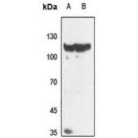 Histone Deacetylase 5/9 Antibody