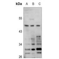 POTEA Antibody