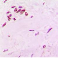 SOX6 Antibody