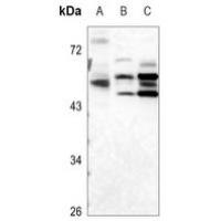 ULK3 Antibody