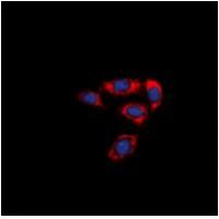 PAR4 Antibody