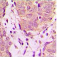 UBXN11 Antibody