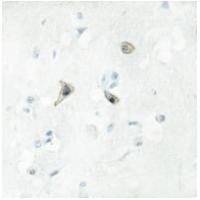 PB Cadherin Antibody