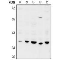 GPRC5D Antibody