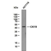 Cytokeratin 19&10 mouse mAb