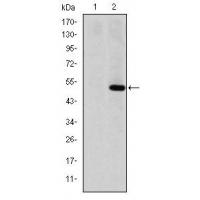 MMP-1 Monoclonal Antibody