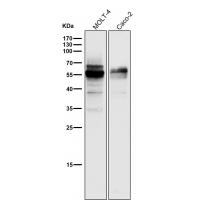 Wilms Tumor Protein Rabbit mAb