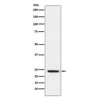 FNDC5 Rabbit mAb