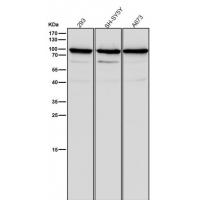 SCIN Rabbit mAb