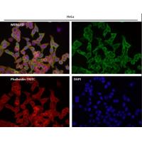 Tissue Factor Rabbit mAb