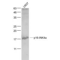 CDKN2A/p16-INK4a Rabbit pAb