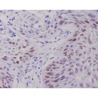 c-Myc Antibody