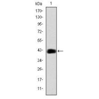 C/EBP β Monoclonal Antibody