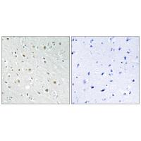 SSBP2 Polyclonal Antibody