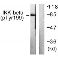 IKK-β(Phospho-Tyr199) Antibody