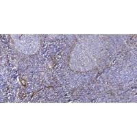 Ataxin-2 Polyclonal Antibody