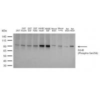 FKHR(Phospho-Ser256) Antibody