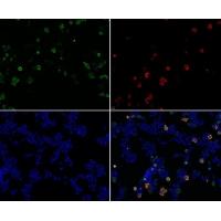 Retrovirus-related Gag Antibody