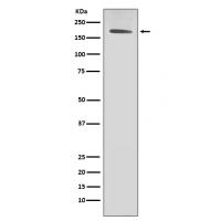 HER2 / ErbB2 Antibody