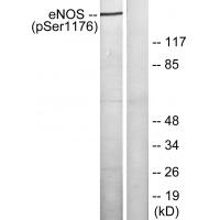 eNOS(Phospho-Ser1177) Antibody