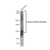 Calcium Sensing Receptor Antibody