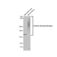 Calcium Sensing Receptor Antibody