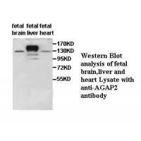 AGAP2 Antibody