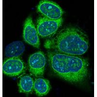 Alkaline Phosphatase Rabbit mAb