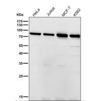 Alkaline Phosphatase Rabbit mAb