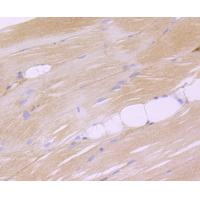 Dysferlin Rabbit mAb